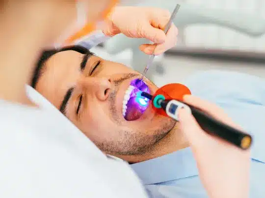 Curing Light Application