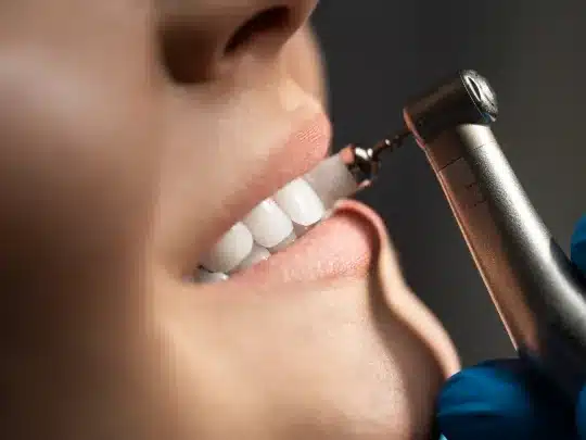 a thorough dental cleaning