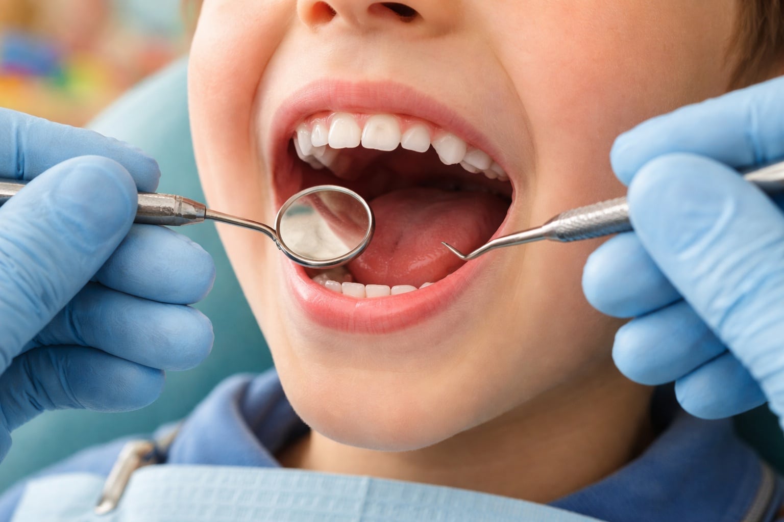 Pediatric Dental Exam Sacramento: X-Rays Explained