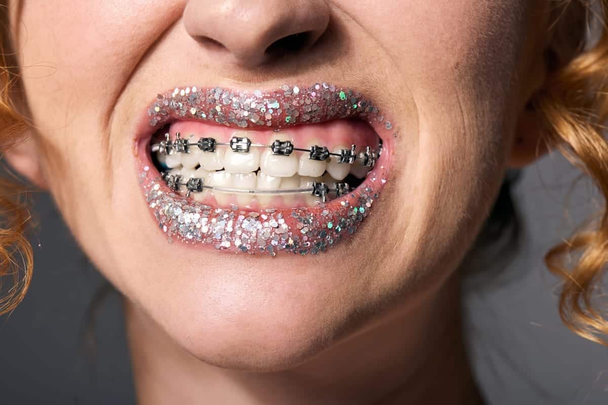 Orthodontics in Parkway