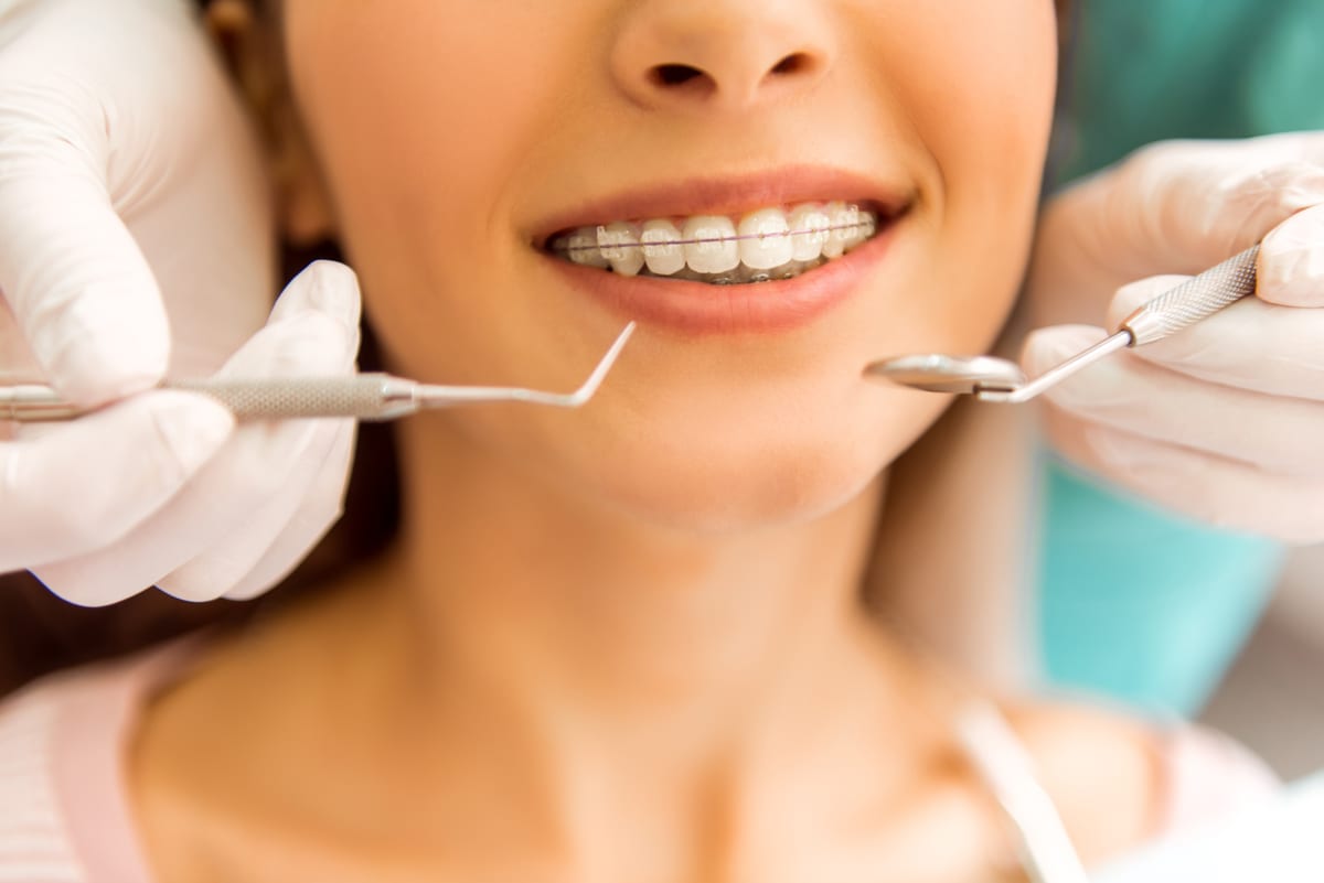 When does my child need braces in Sacramento
